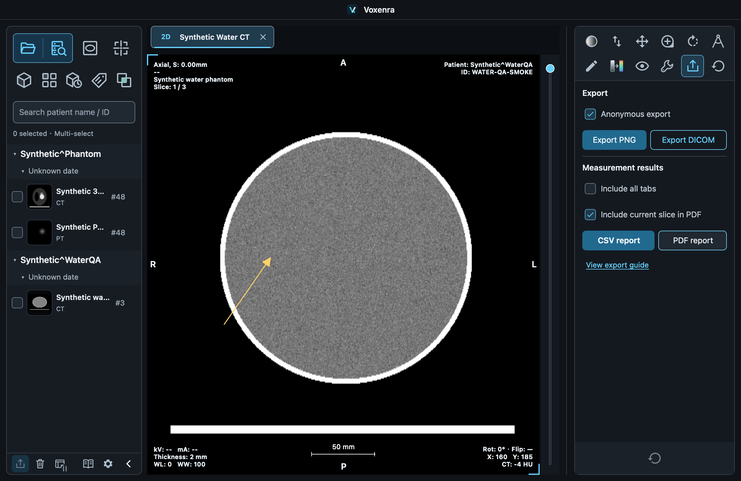 Anonymization, image exports and measurement reports.