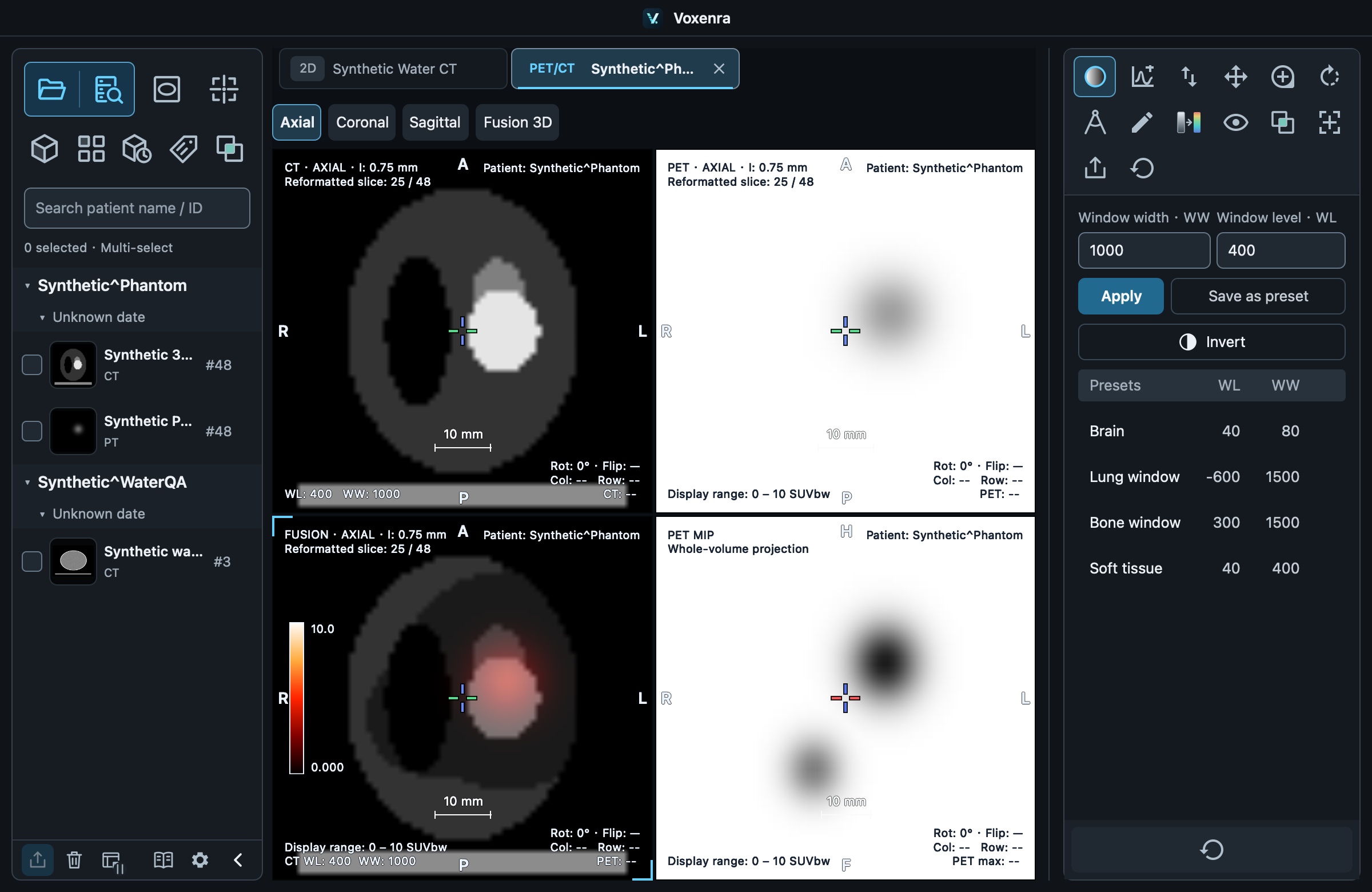 CT, PET, FUSION and PET MIP.