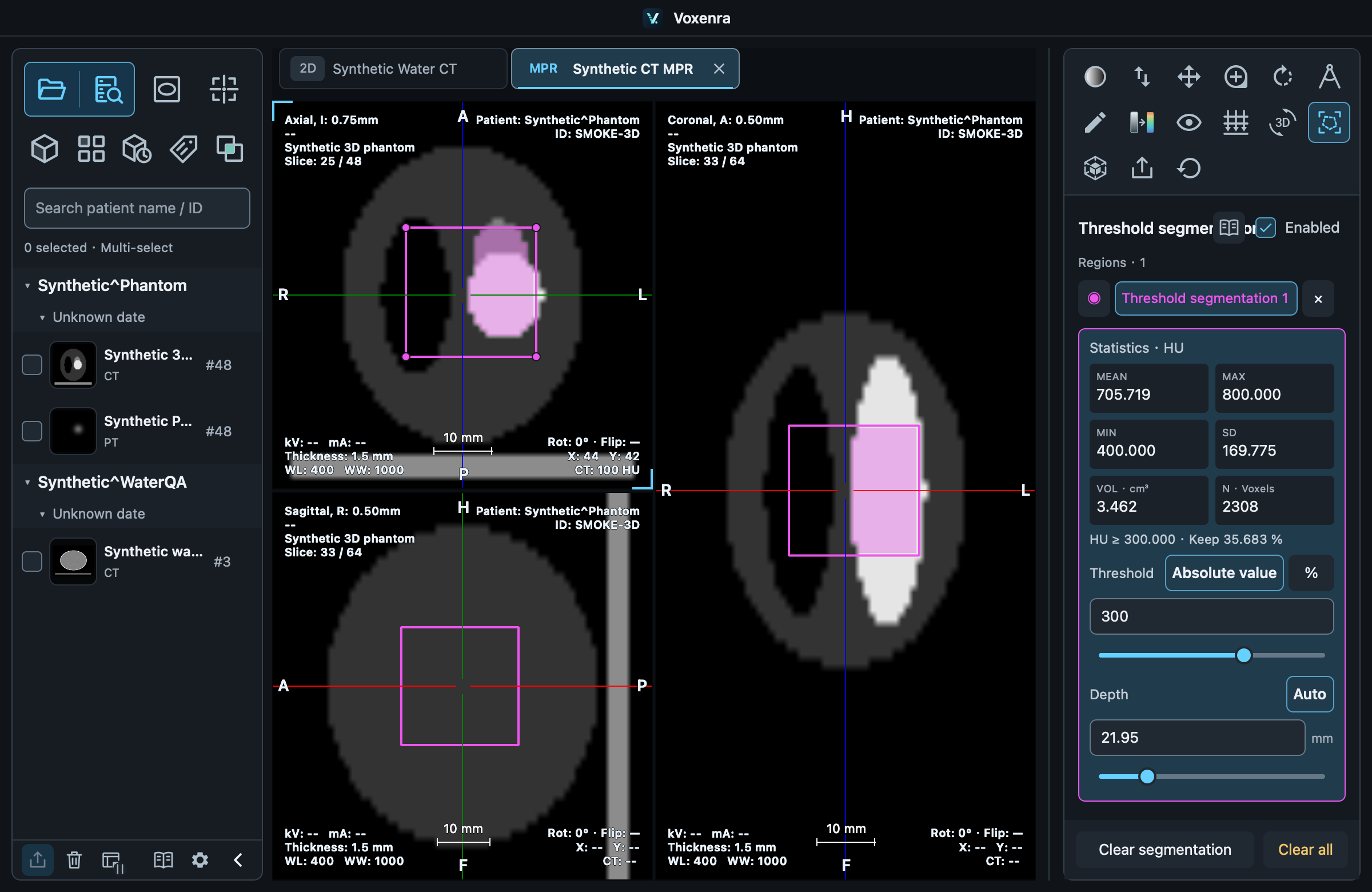 CT example